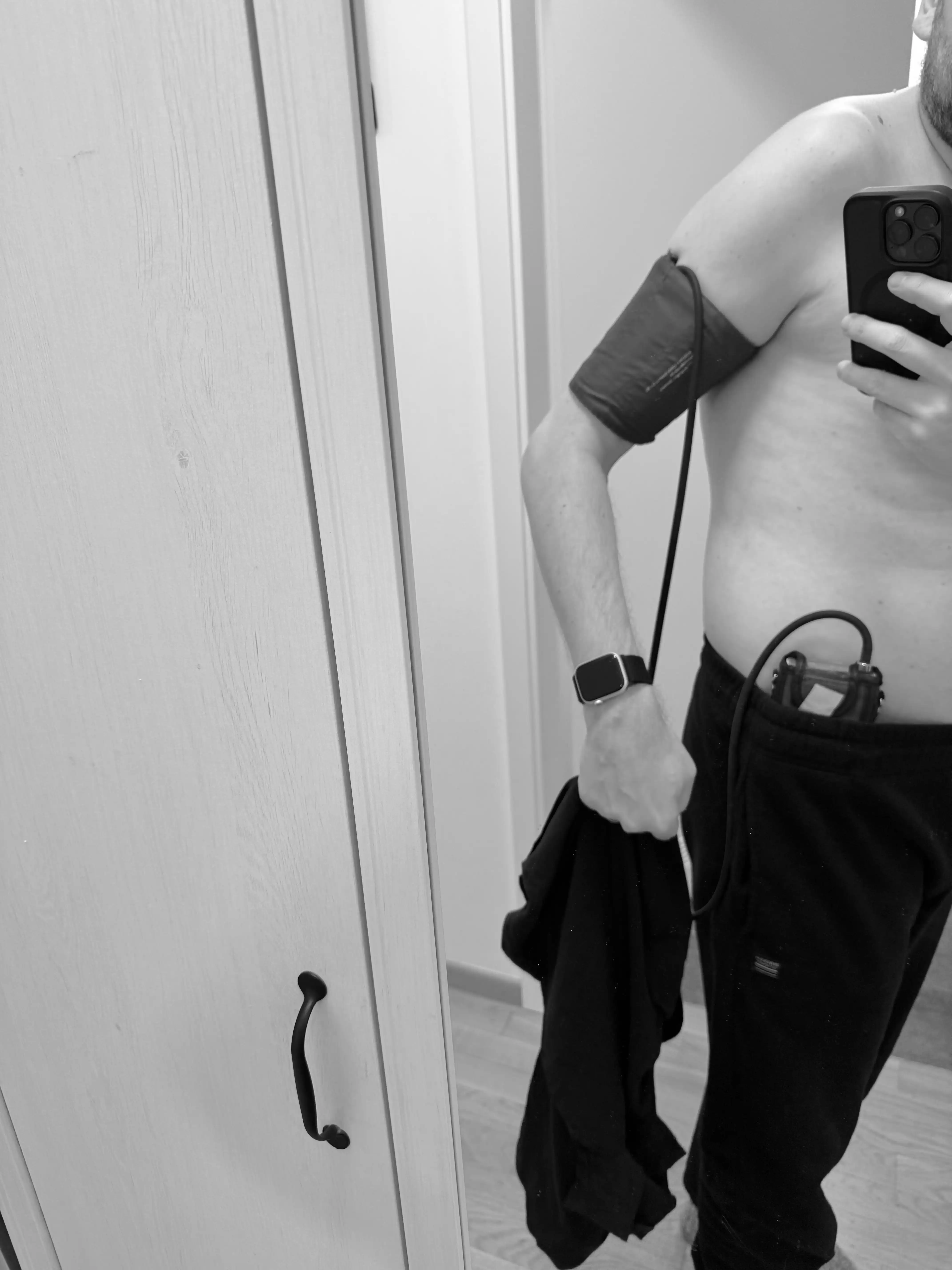 Stefan purtand aparatul Holter de monitorizare a tensiunii arteriale timp de 24 de ore